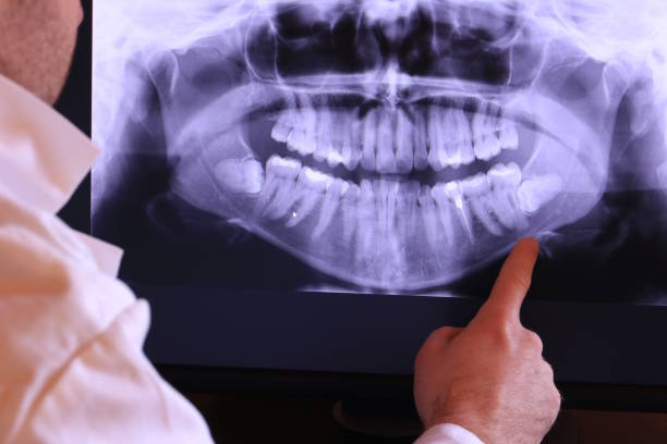 Best Emergency Wisdom Teeth Removal in Church Hill, PA
